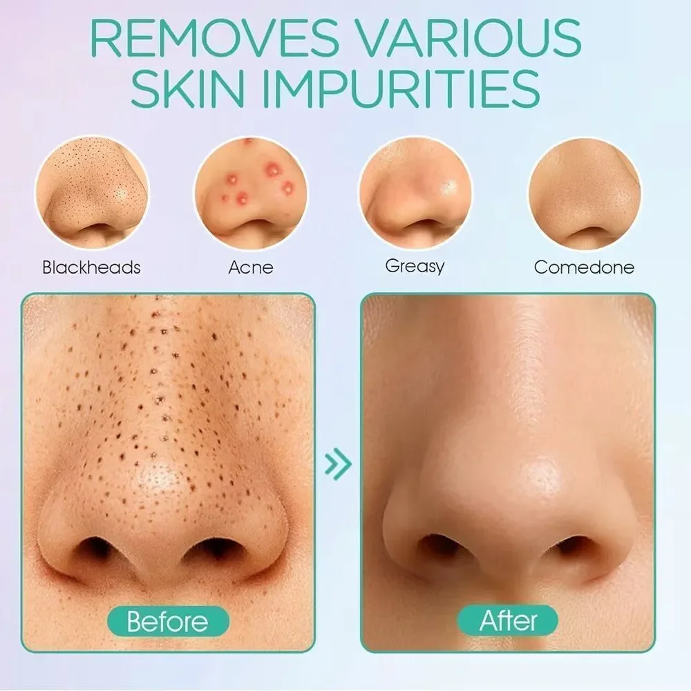 Pore vacuum
